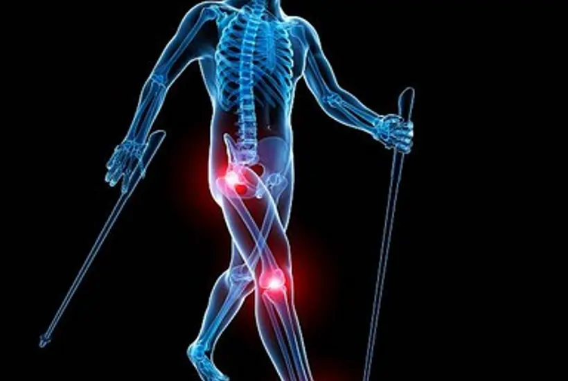 Arthrose : quelles précautions prendre pour randonner ?